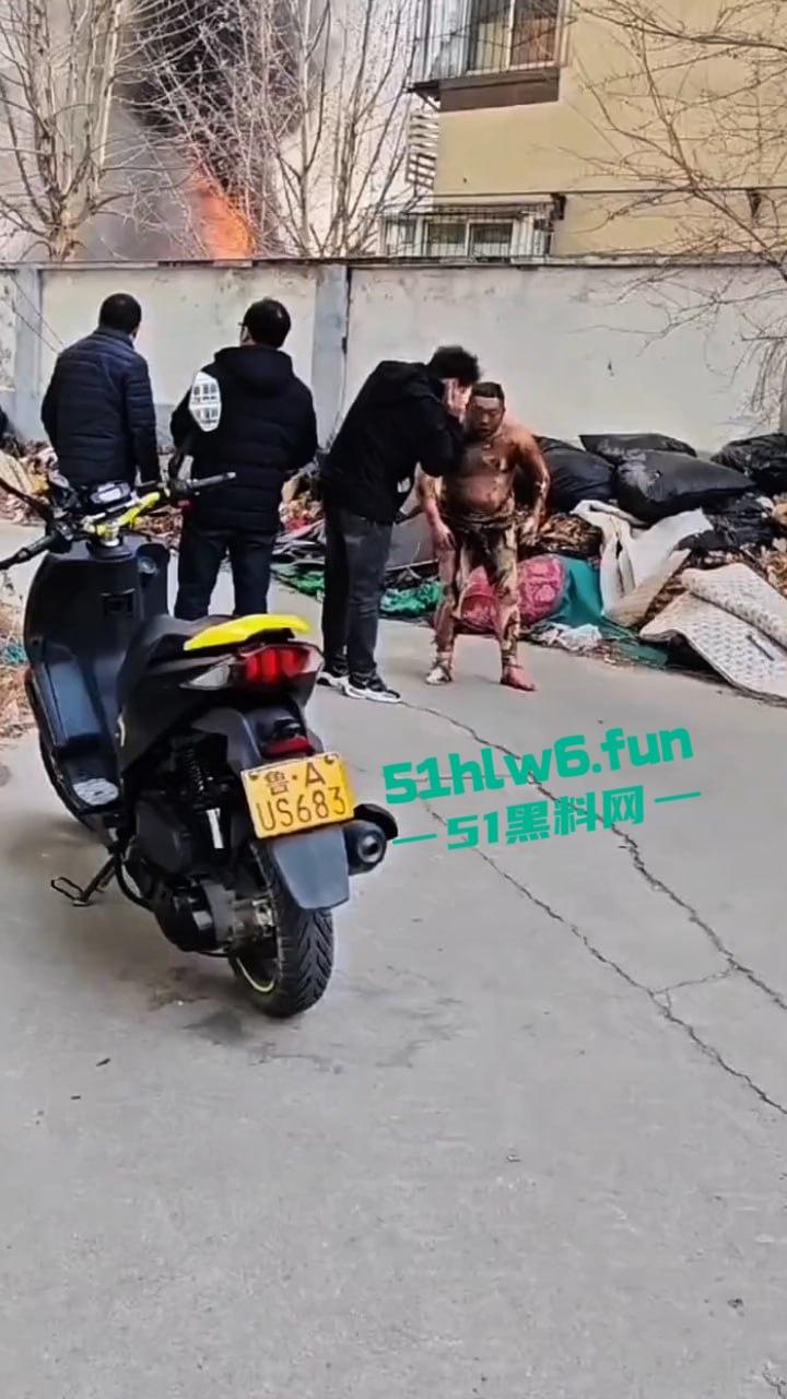 山东济南一小区发生火灾，男子被烧的体无完肤，经调查是邻居大妈积攒的废品导致烧成这样也太惨了。-1