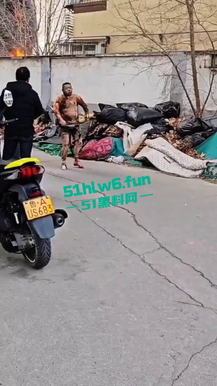 山东济南一小区发生火灾，男子被烧的体无完肤，经调查是邻居大妈积攒的废品导致烧成这样也太惨了。-4