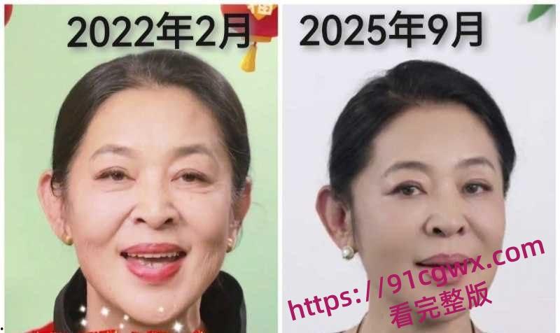 李连杰洪金宝倪萍脱胎换骨 疑似器官移植续命年轻20岁 轮椅变健步黑发红润！-9