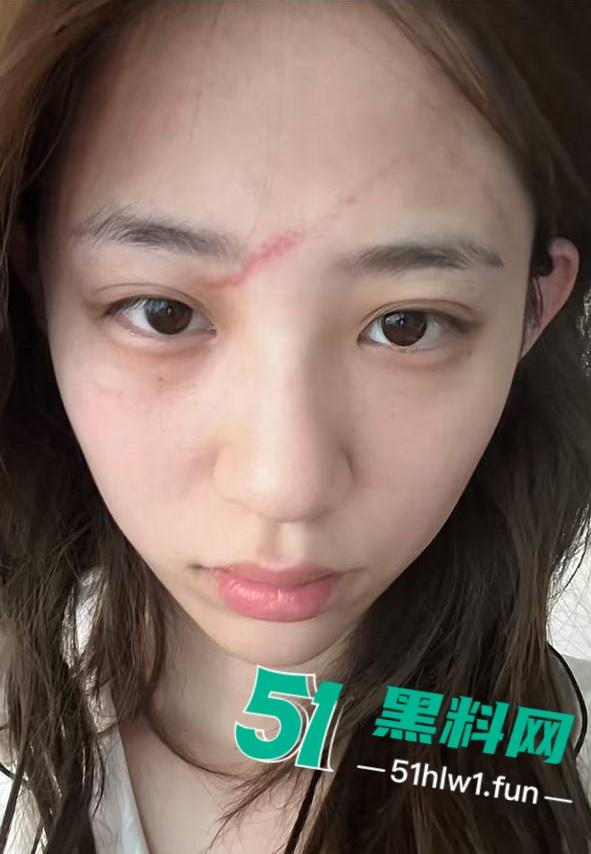 两位抖音百万网红，前CUBA成员【程鑫凯】家暴【鸡腿诺】事件持续发酵，未流出资料曝光完整吃瓜。-31