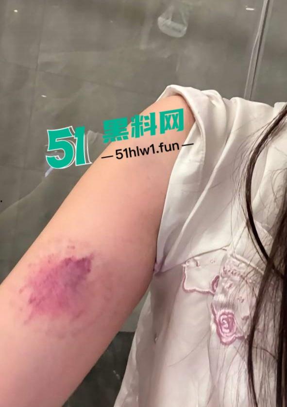 两位抖音百万网红，前CUBA成员【程鑫凯】家暴【鸡腿诺】事件持续发酵，未流出资料曝光完整吃瓜。-39