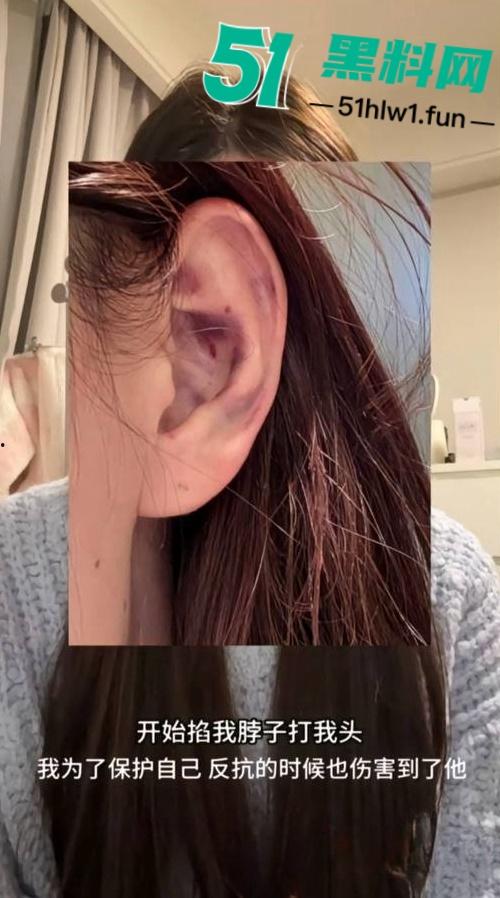 两位抖音百万网红，前CUBA成员【程鑫凯】家暴【鸡腿诺】事件持续发酵，未流出资料曝光完整吃瓜。-40