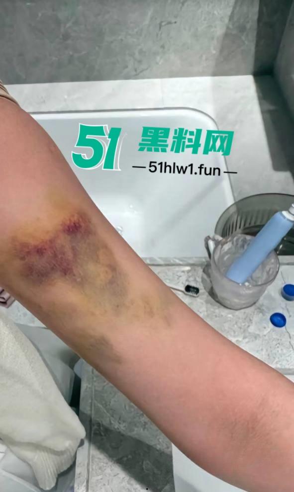 两位抖音百万网红，前CUBA成员【程鑫凯】家暴【鸡腿诺】事件持续发酵，未流出资料曝光完整吃瓜。-42